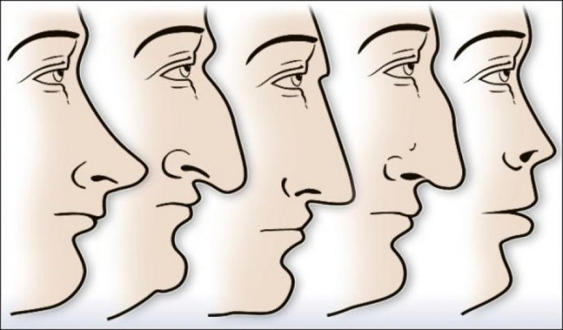Forma e hundes tregon per karakterin tuaj